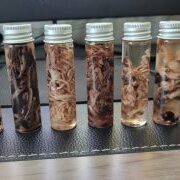 Fibrous clots found in corpses by Richard Hirschman. (Courtesy of Richard Hirschman) Fibrous clots found in corpses by Richard Hirschman. (Courtesy of Richard Hirschman)