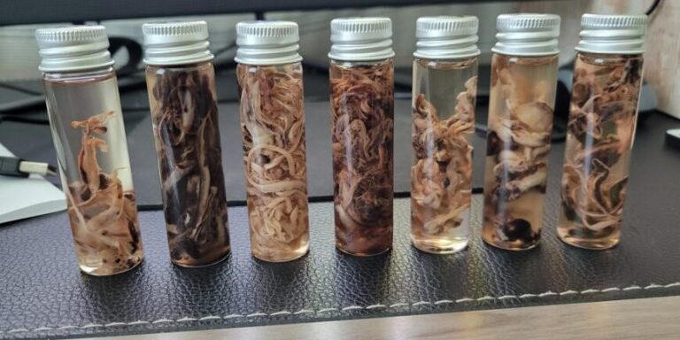 Fibrous clots found in corpses by Richard Hirschman. (Courtesy of Richard Hirschman)